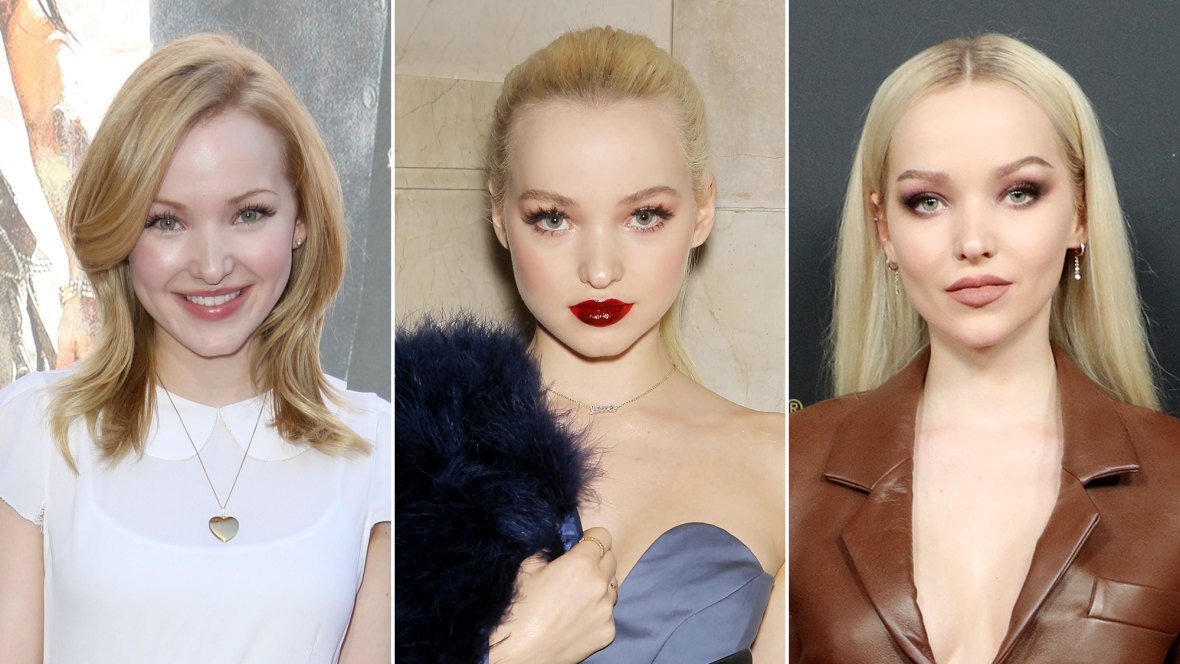 Dove Cameron plastic surgery