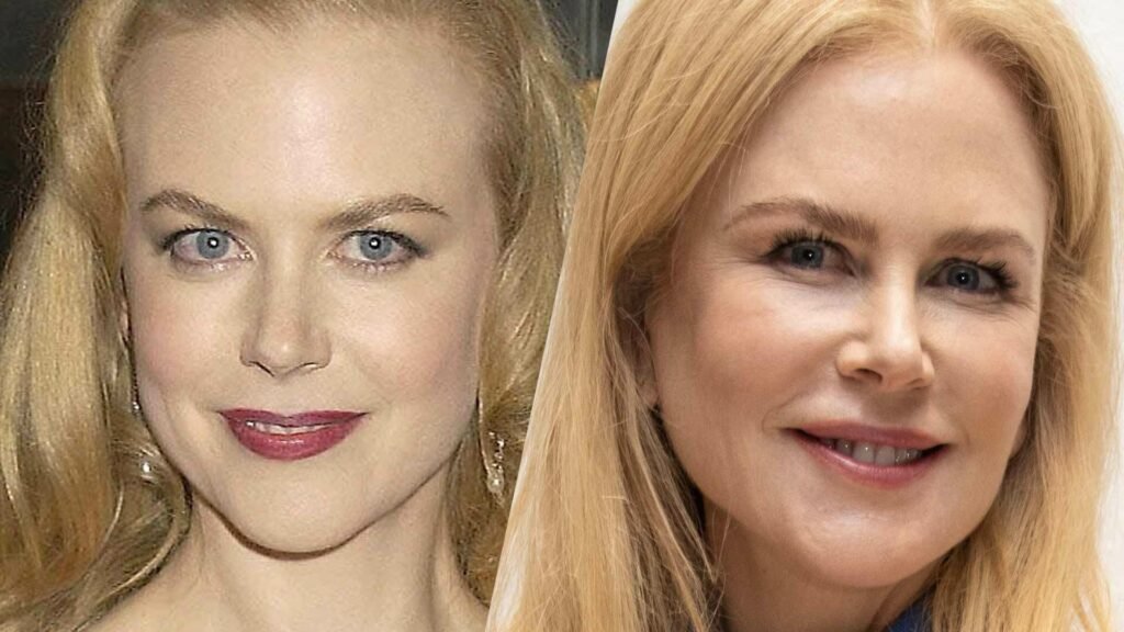 Nicole Kidman Plastic Surgery