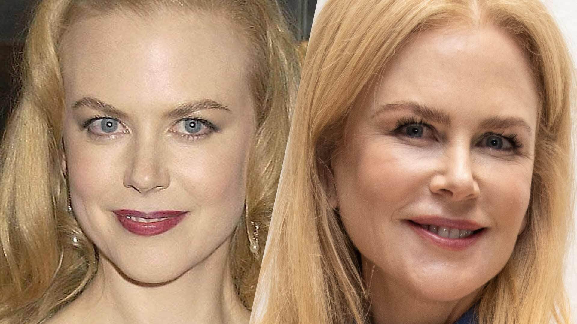 Nicole Kidman Before and After Plastic Surgery Looks - Stanford Arts Review