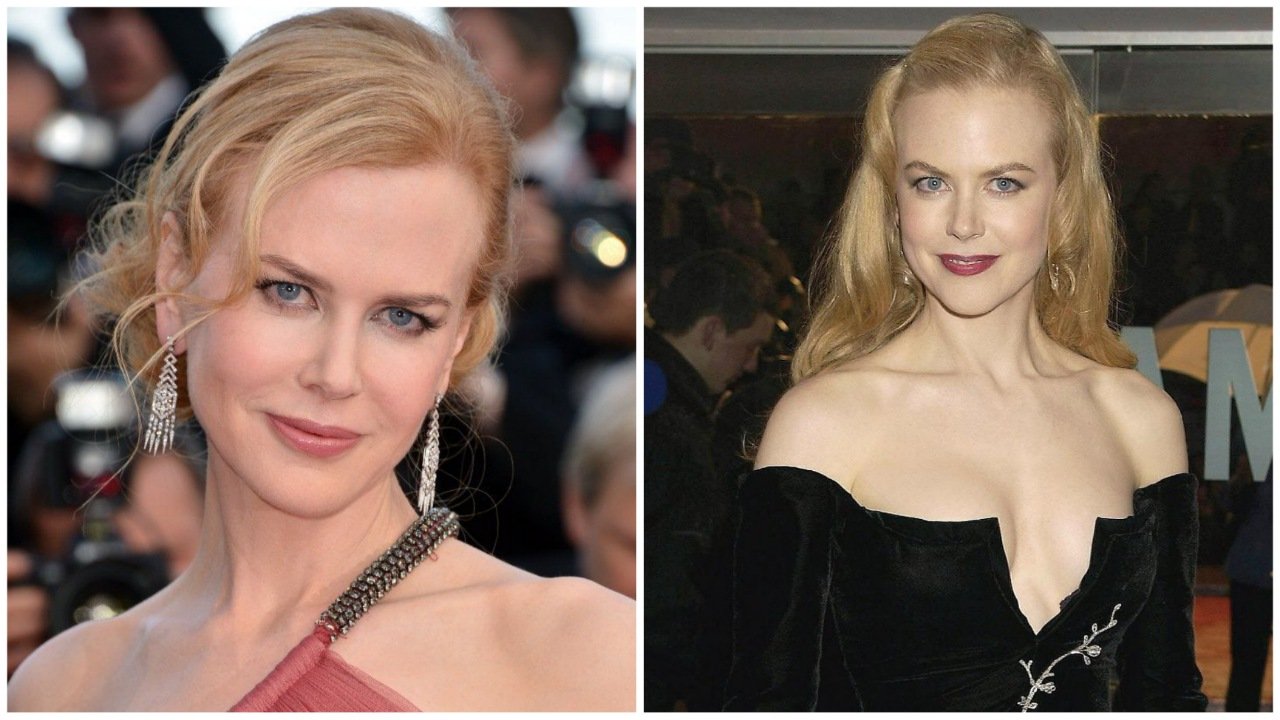 Nicole Kidman plastic surgery