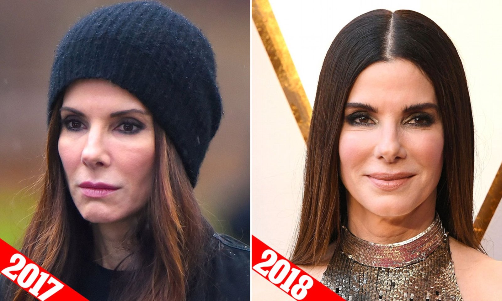 Sandra Bullock Plastic Surgery