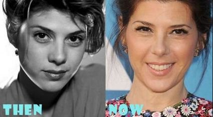 Marisa Tomei Plastic Surgery