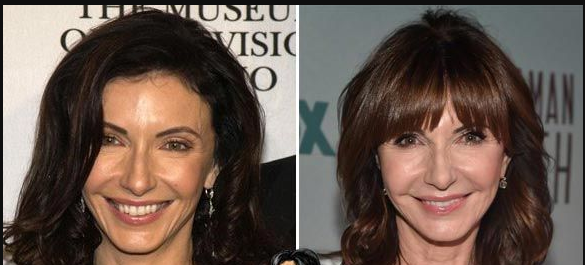 Mary Steenburgen Plastic Surgery