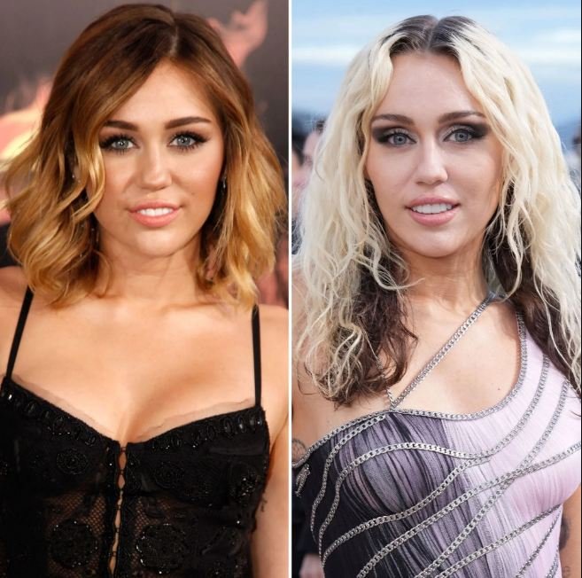 miley cyrus plastic surgery