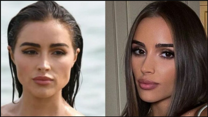 Olivia Culpo plastic surgery