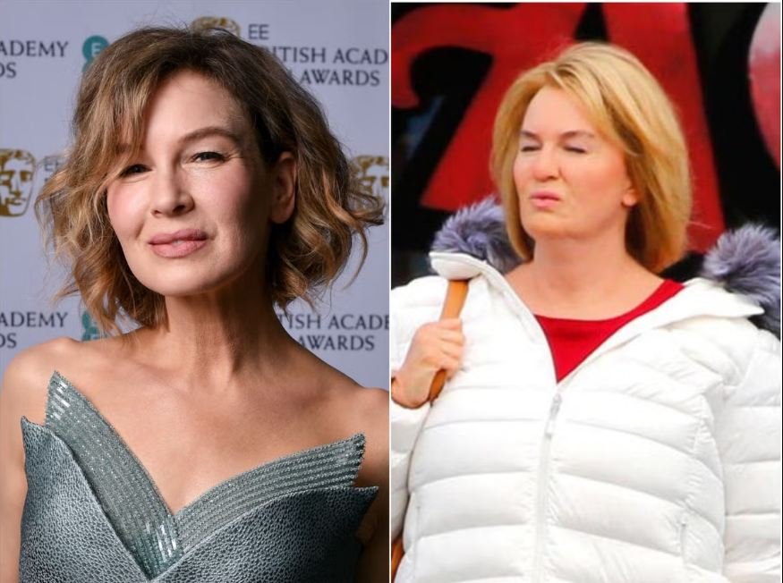 renee zellweger lip job